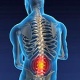 Πόνοι κάτω μέρους της πλάτης (οσφυαλγία): Πόσο χρήσιμες είναι η ακτινογραφία, η μαγνητική τομογραφία (MRI) και η αξονική τομογραφία (CT scan);