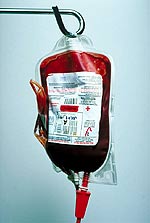 Η μετάγγιση αίματος δεν μεταδίδει τον καρκίνο.