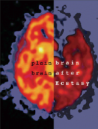 Η φωτογραφία αυτή δείχνει τον κανονικό εγκέφαλο (αριστερά) και τον εγκέφαλο ατόμου που παίρνει το ναρκωτικό Έκσταση (δεξιά). Φαίνεται καθαρά ότι ο εγκέφαλος του χρήστη του ναρκωτικού έχει υποστεί σημαντική βλάβη.