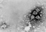 Ηλεκτρονική φωτογραφία του ιού της ηπατίτιδας Β (Dane particle), photo credit CDC.