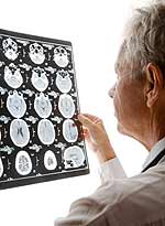 Οι ασθενείς με τραύμα στον εγκέφαλο υποφέρουν από μακροχρόνιες νευρολογικές και ψυχιατρικές διαταραχές.