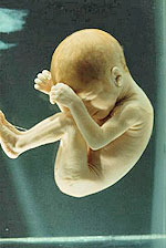 Στρες και αποβολή: Οι πλείστες περιπτώσεις αποβολών οφείλονται σε ανωμαλίες του εμβρύου