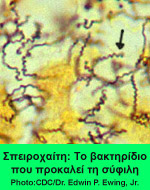 Στη φωτογραφία φαίνεται η σπειροχαίτη, που είναι το μικρόβιο που προκαλεί τη σύφιλη 